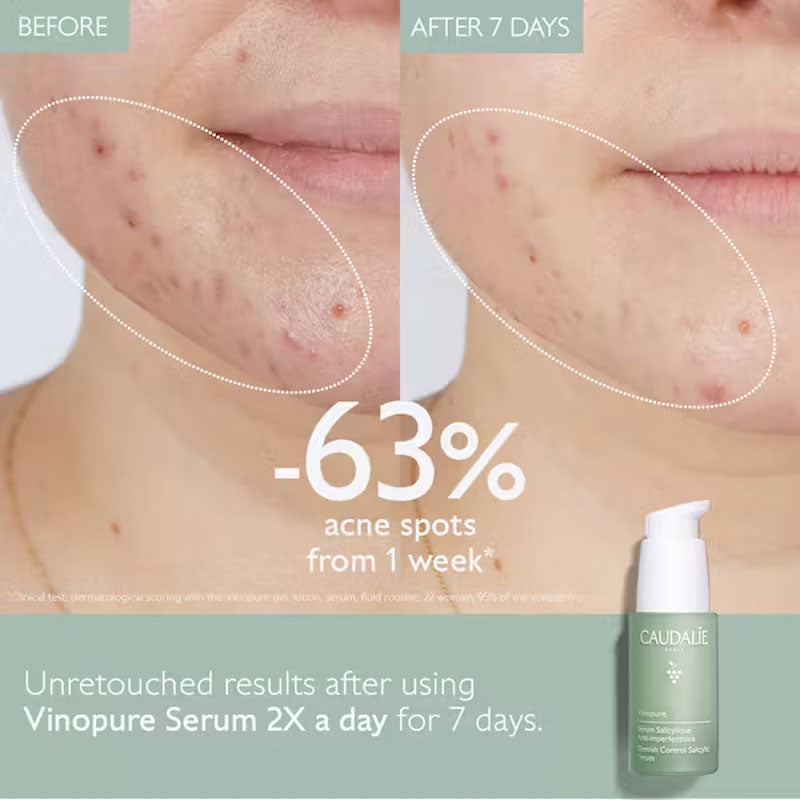 Vinopure Blemish Control Salicylic Serum 30ml